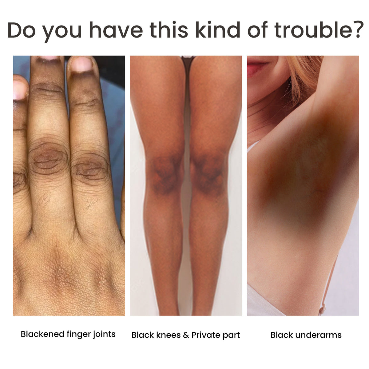 Women&#39;s Skin Pigmentation Care